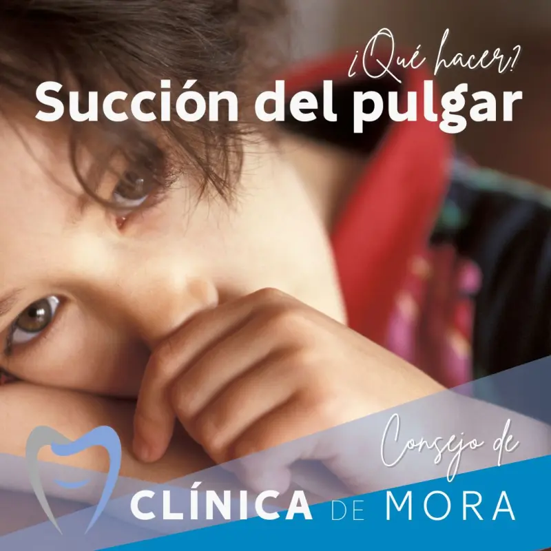 La succión del pulgar en los niños: ¿afecta a su salud oral?