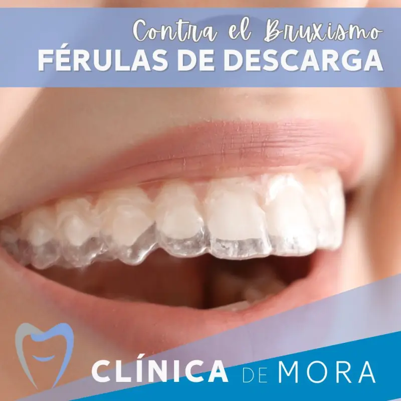 https://clinicademora.es/imagenes/bruxismo_ferulas_dentales%20_clinica_de_mora.webp